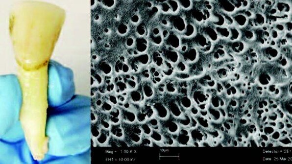 Νέα οδοντική εξέταση υποδεικνύει τη χρήση φαρμάκων και ναρκωτικών ουσιών