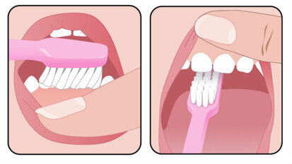 Un sorriso sano, durante la gravidanza e oltre