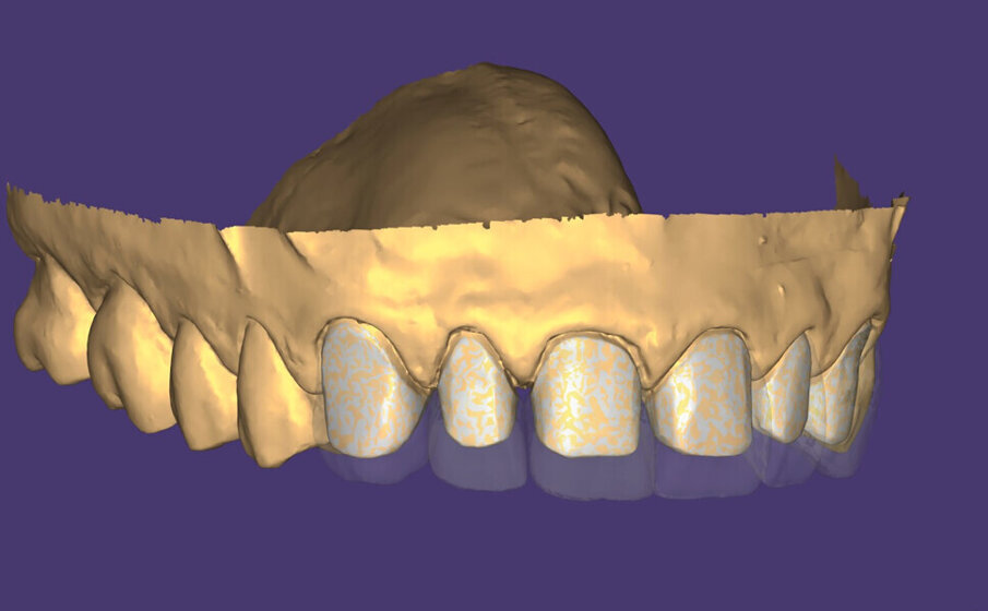 Obr. 12: Kontrola tloušťky.