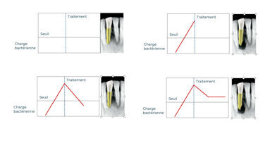 Pourquoi certaines lésions endodontiques guérissent et d’autres pas ?