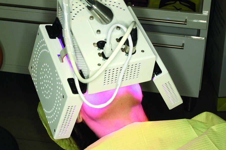 Fig. 2 - Seduta di foto-bio-modulazione (biostimolazione) con l’ATP38®, ogni mese in ortodonzia fissa e ogni 15 giorni nel trattamento con mascherine allineatrici. Il trattamento dura 300 secondi.