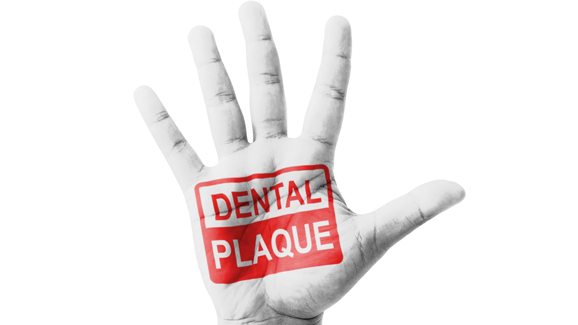 So stoppt Speichel die Kariesbildung