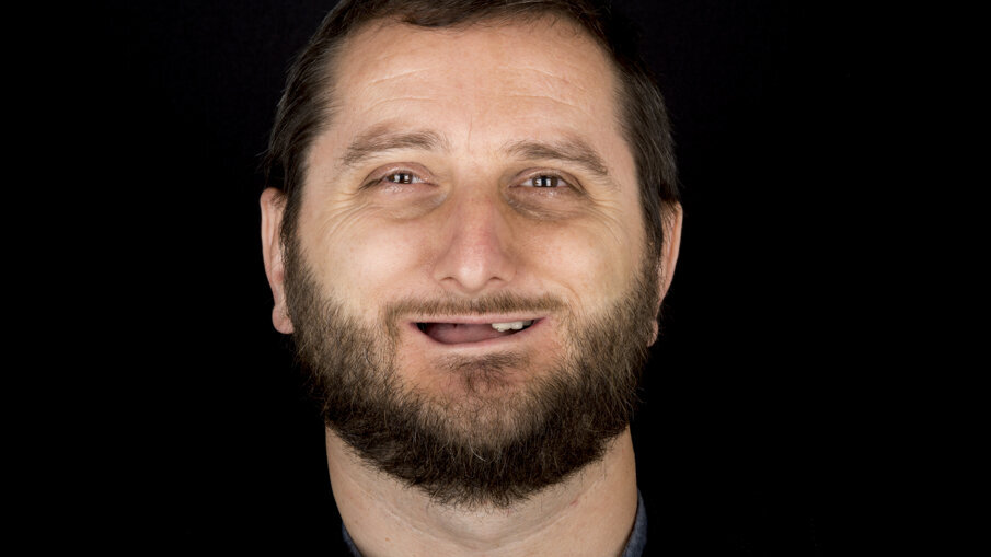 Figg. 1-3 - Fotografie preoperatorie. 