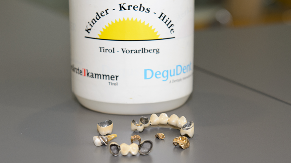 Zahngold für die Kinderkrebshilfe