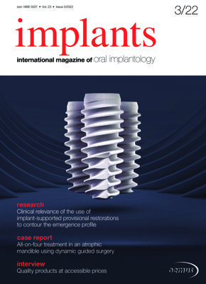 implants international No. 3, 2022 implants international No. 3, 2022