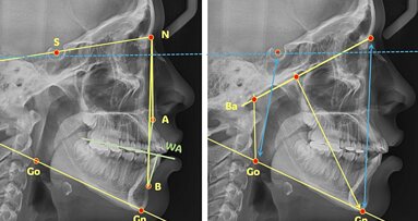 La cefalometría debe contestar las siguientes preguntas