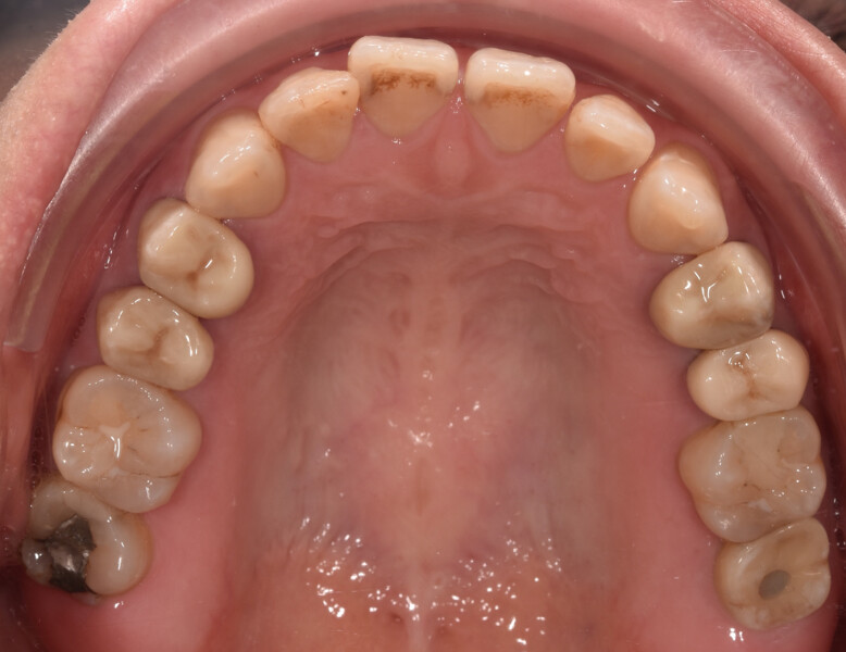 Fig. 2d