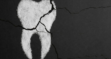 Report sheds light on dental service in Northern Ireland since onset of pandemic