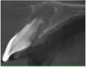 Ryc. 2_TK przedzabiegowe.