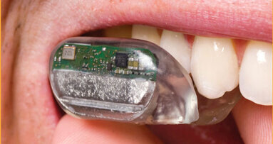 Neuartiges Hörgerät wird im Mund platziert