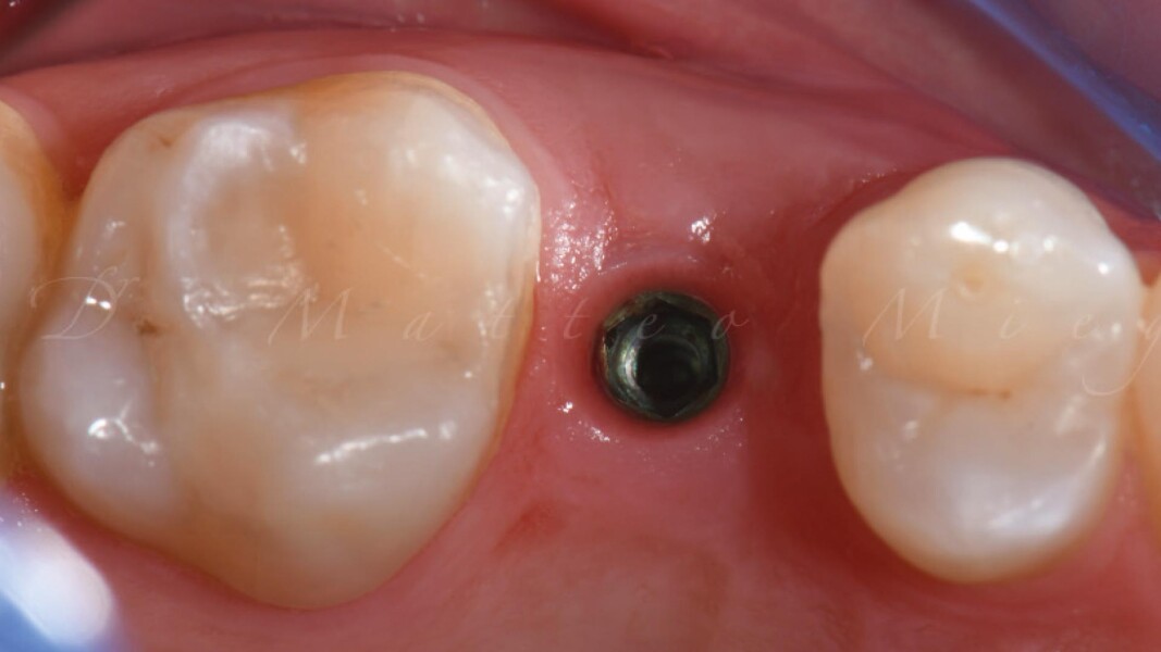 Fig. 7_Tessuto cheratinizzato.