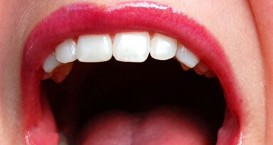 Academy of Laser Dentistry partners with OralID to raise awareness of oral cancer