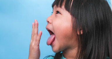 Un colorant rouge offre des avantages dans le traitement de l'halitose pédiatrique — étude