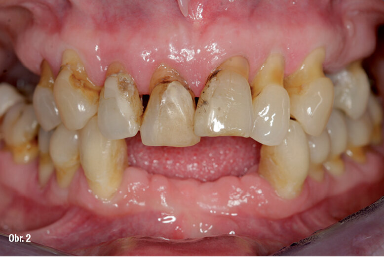 Výchozí situace v ústech