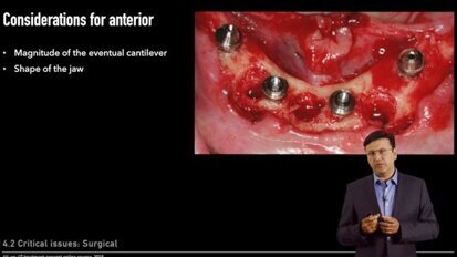 Nobel Biocare представя безплатен онлайн курс за системата All-on-4