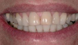 Afbeelding 10: Het beginbeeld.