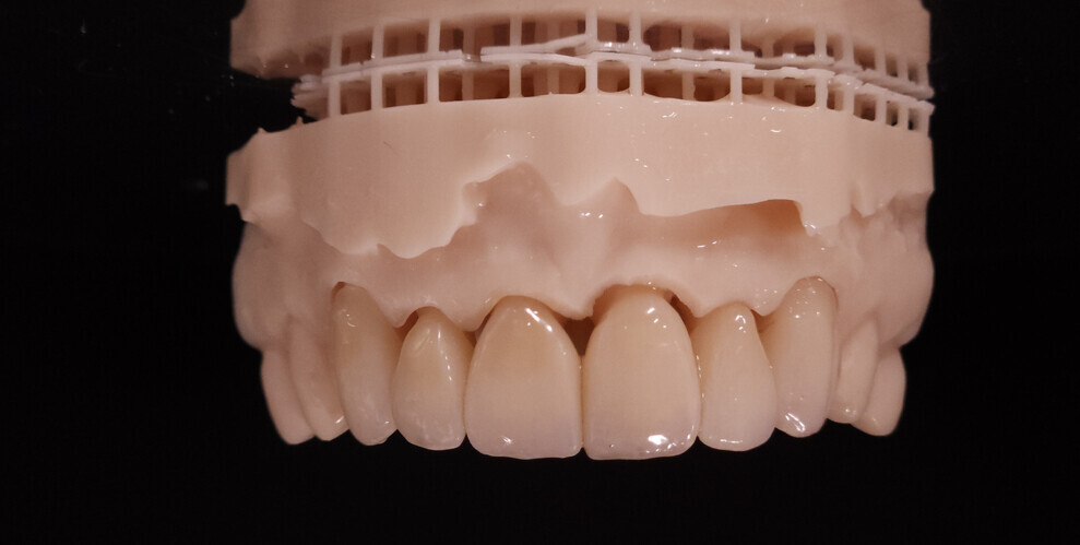 Digital technology in dentistry has transformed workflows, enabling faster, more precise and efficient production of restorations.