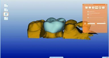 CAD/CAM Technology: a review