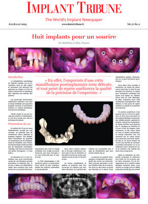 Implant Tribune France No. 1, 2025 Implant Tribune France No. 1, 2025