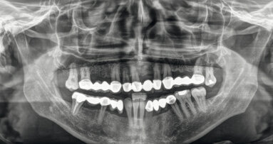 L’odontoiatra può svolgere l’attività radiodiagnostica complementare