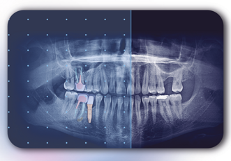 Allisone Technologies – Allisone