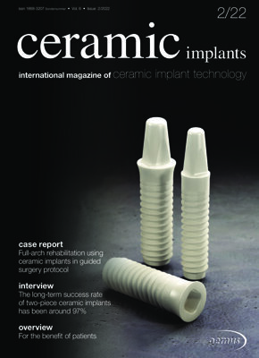 ceramic implants international No. 2, 2022 ceramic implants international No. 2, 2022