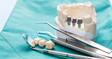 Association between clinical and  demographic variables and the success  of single-tooth dental implants: A cross-sectional study