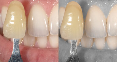 La cámara más sofisticada y fácil de usar