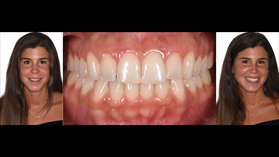 Fig. 17_Followup a 24 mesi.