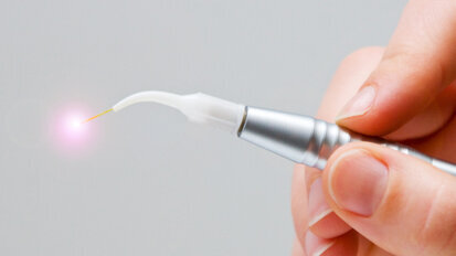 Innovative Lasertechnologie: Prävention statt Restauration Innovative Lasertechnologie: Prävention statt Restauration