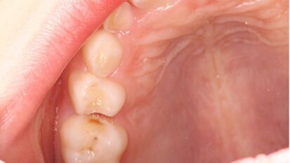 Preventie: een kwestie van volhouden