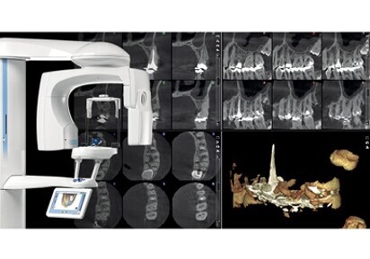 New endodontic imaging mode from Planmeca — detailed images without noise or artefacts