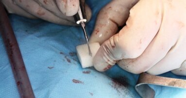 Osteovit jako materiał augmentacyjny – alternatywa dla kości autogennej