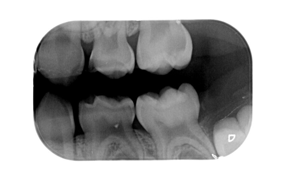 Afbeelding 10. Casus 3: 18-10-19. BWL, zie 65.