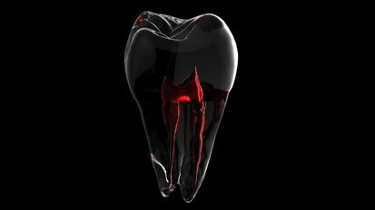 Sesja „Endodoncja” na targach Krakdent 2023
