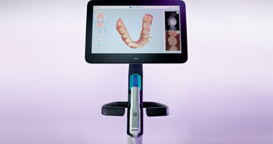 Společnost Align Technology uvádí na český trh software iTero Workflow 2.0