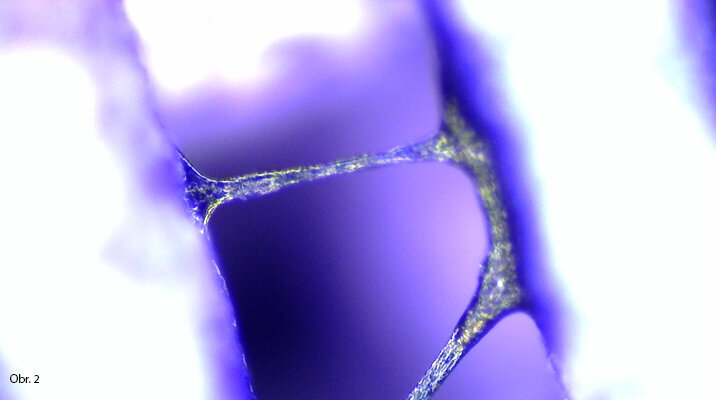 Mezi trámci scaffoldu se vytváří buněčné můstky. Pokud je lešení degradovatelné, buňky vytváří náhradní tkáň.