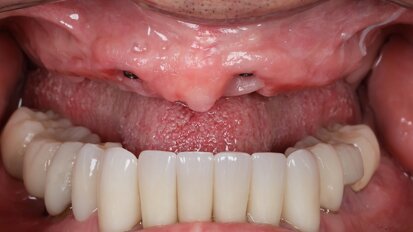 ¿Qué es, cómo funciona y para qué sirve la fotogrametría?