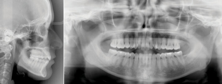 Vstupní foto a RTG dokumentace