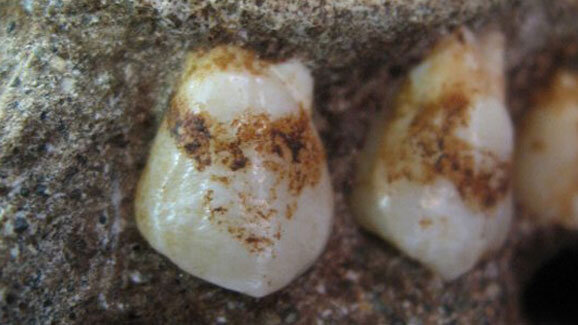 Pflanzenreste in zwei Millionen Jahre altem Zahnbelag entdeckt