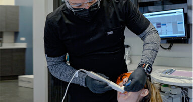 SHINING 3D presenta Aoralscan Elite con la rivoluzionaria tecnologia IPG