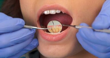 GC America apresentará seminário ao vivo focado em biofilme