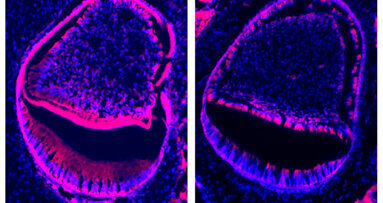 Genetic discovery could lead to advances in dental treatment