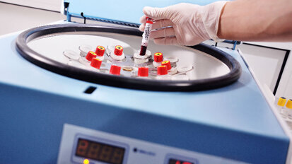 Prevenzione e cura delle osteonecrosi della ossa mascellari con concentrati piastrinici autologhi