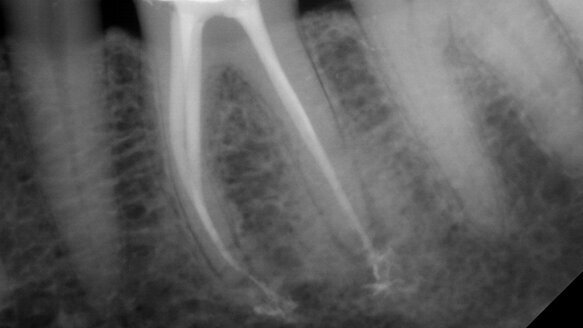 Using hand files to their full capabilities: A new look at an old yet emerging technology
