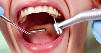 Brits prefer dental checks over taxes