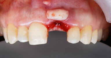 “We can look forward to decisive progress in soft-tissue regeneration in the coming years”