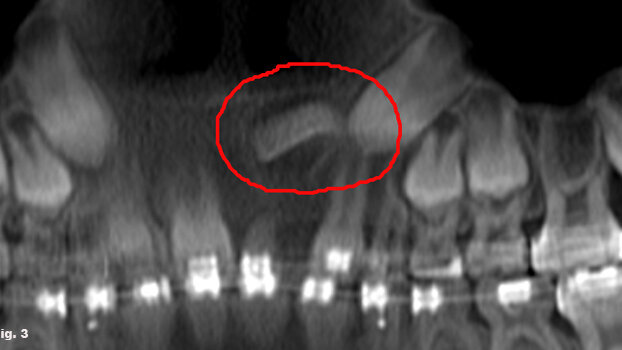 Straight talk on 3-D imaging from an orthodontist