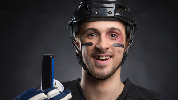 Sport ist schlecht für die Zähne