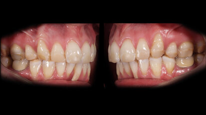 Ricostruzioni estetiche complesse: metodi digitali e protocolli operativi integrati